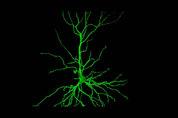 Neuron in hippocampus of mouse brain