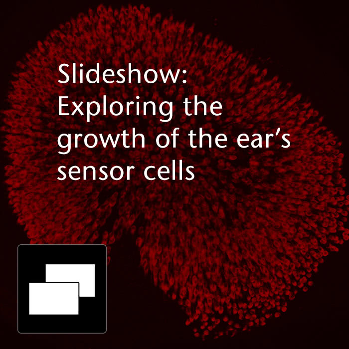 Slideshow: Exploring the growth of the ear's sensor cells