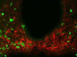 Curb your appetite: Scientists found evidence of the metabolism-regulating protein amylin, shown in red, present in multiple regions throughout a brain area called the hypothalamus. Experiments suggest amylin produced by hypothalamic neurons is part of a regulatory system that helps reduce food consumption in concert with leptin. 