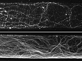 Message from headquarters: Axons of normal neurons, shown on top, degenerate when deprived of NGF. However the axons of neurons that lack the protein Puma remain intact (shown below), indicating that their degeneration is controlled by Puma and the cell body 