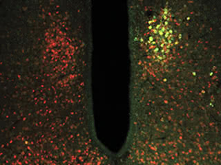 Open wide: The TRPV1 ion channel coupled with ferritin (green) was targeted to glucose-sensing neurons (red). Ferritin allows the ion channel to open in response to magnetic forces, activating or inhibiting the neurons. Changing the activity of glucose-sensing neurons had downstream effects on blood glucose metabolism.