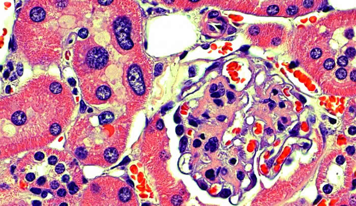 This nucleus is too big: Kidney cells from 18 month old FAN1 knockout mice exhibit karyomegaly, or enlarged nuclei, in the tubules but not in the glomeruli. 