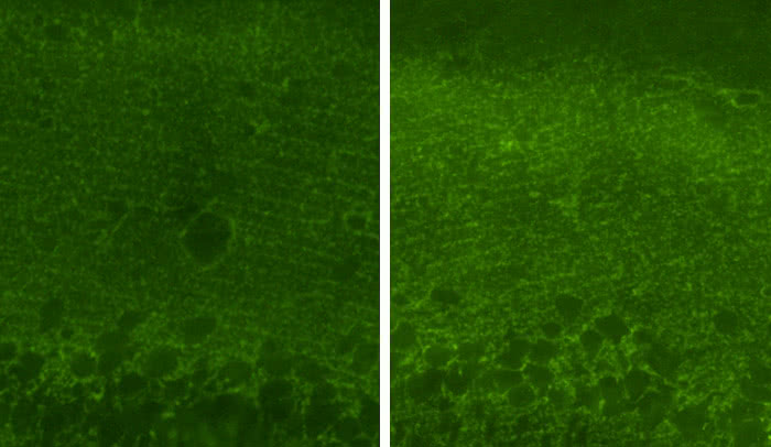 microscopy showing increased fluoresence in brains of riluzole treated rats