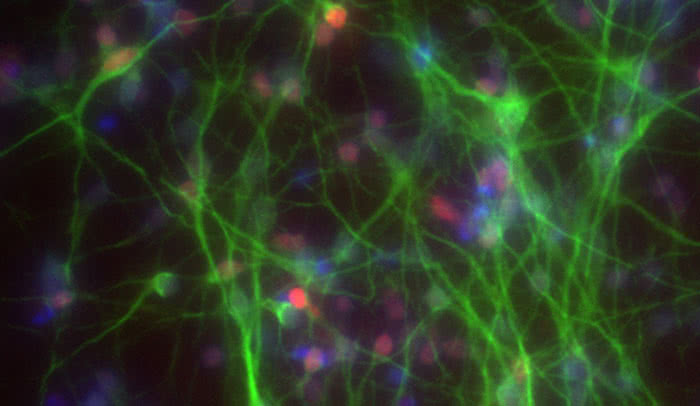 Out of body: Researchers in the Tessier-Lavigne lab use human brain neurons (above) derived from stem cells to study dementia. A new approach developed in the lab allows them to more efficiently introduce mutations associated with diseases, such as Alzheimer’s. 