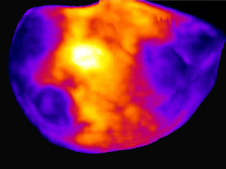 Mouse brain activity mapping