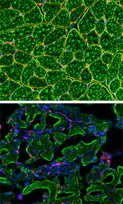 Fig5a_NW Musc Dys