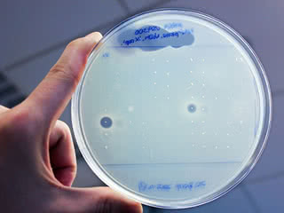 MRSA screen