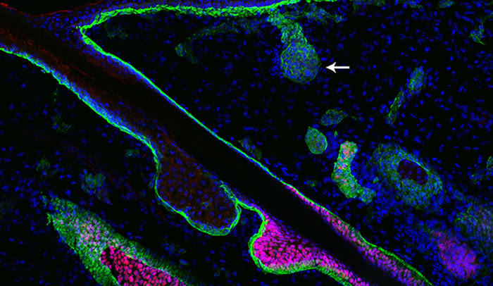 Hair first, sweat later: Researchers found that two opposing signaling pathways guide the formation of hair follicles and sweat glands. In humans, hair follicles emerge first (pink), followed by sweat glands (arrowhead).