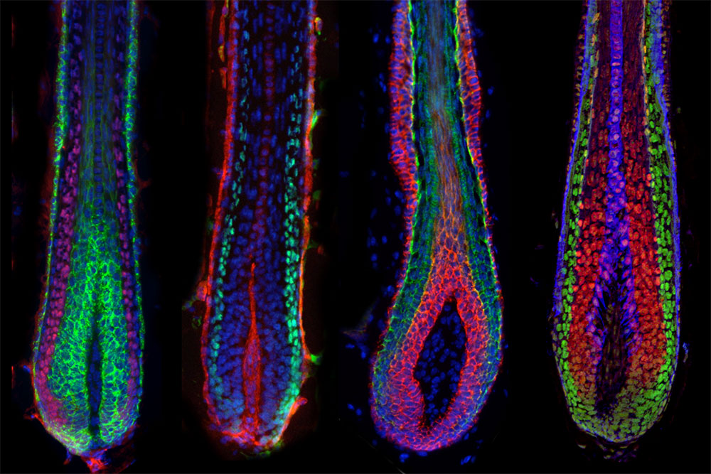 Hair follicle micro-niche