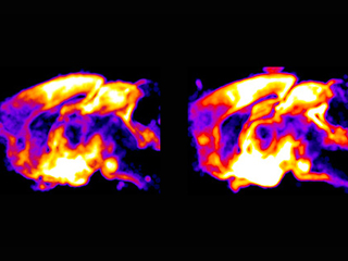 Hunger brain regions