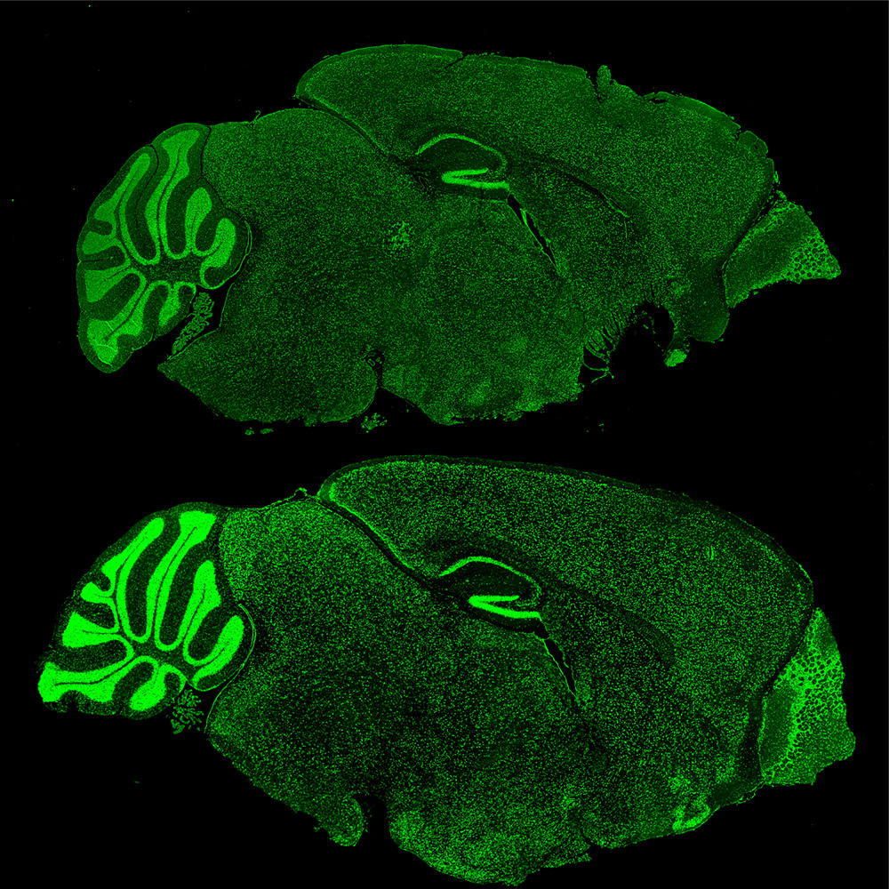 Fragile X brains