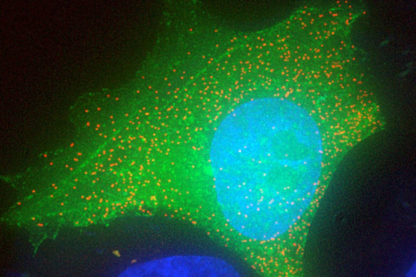 A human cell (green) infected with HIV (red)