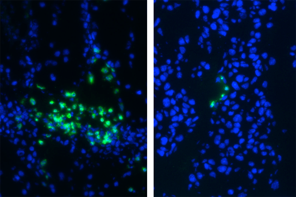 myeloid-derived suppressor cells