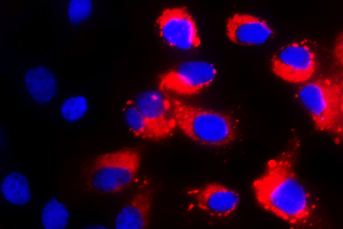 Stem cells lacking their protective genes are susceptible to infection by the dengue virus, in red.