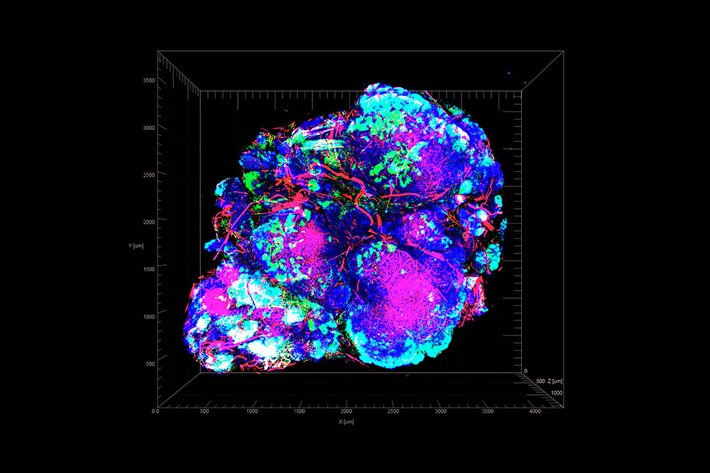 Tumor, imaged in a mouse model