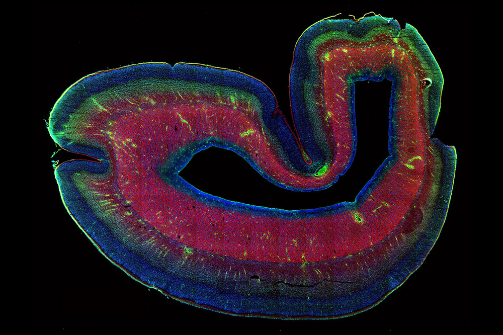 The subplate (green) as it sits directly below the developing cortex