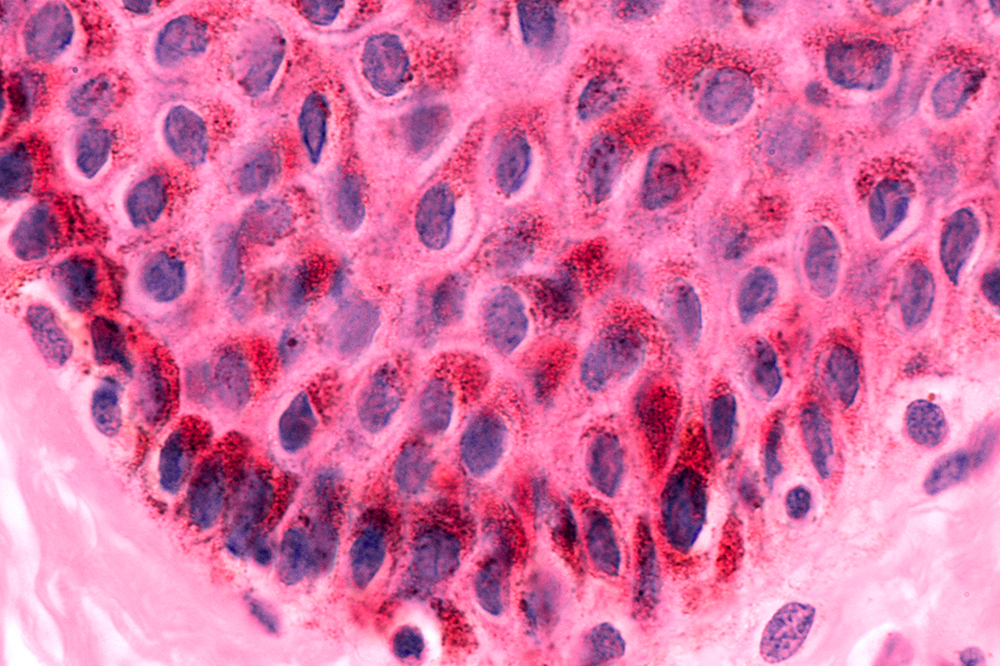 Keratinocyte skin cells