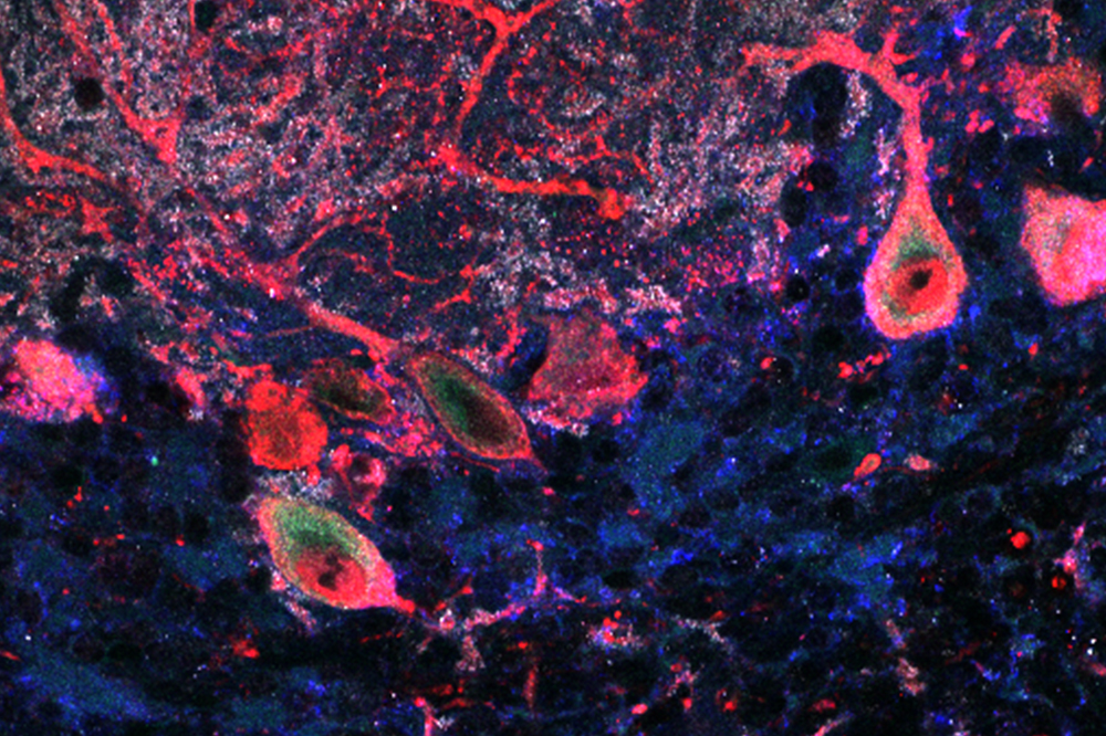 ASTN2 naturally expressed by purkinje cells in the mouse cerebellum