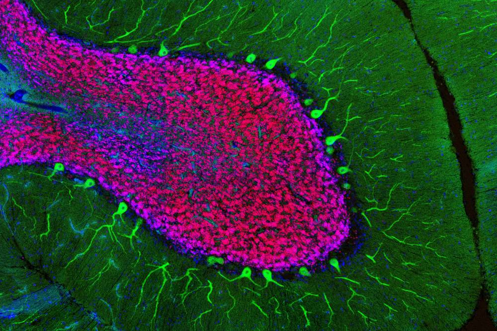 The researchers studied neurons from the cerebellum, a brain region involved in coordinating movement. Photo credit: Elitsa Stoyanova and Maria V. Moya