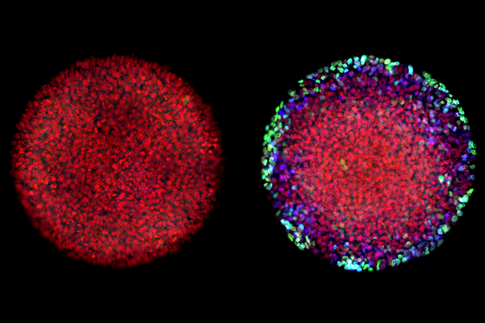 When lab-grown embryos were exposed to Activin alone, they failed to differentiate (left). Following exposure to both WNT and Activin, distinct cell types emerged (right).