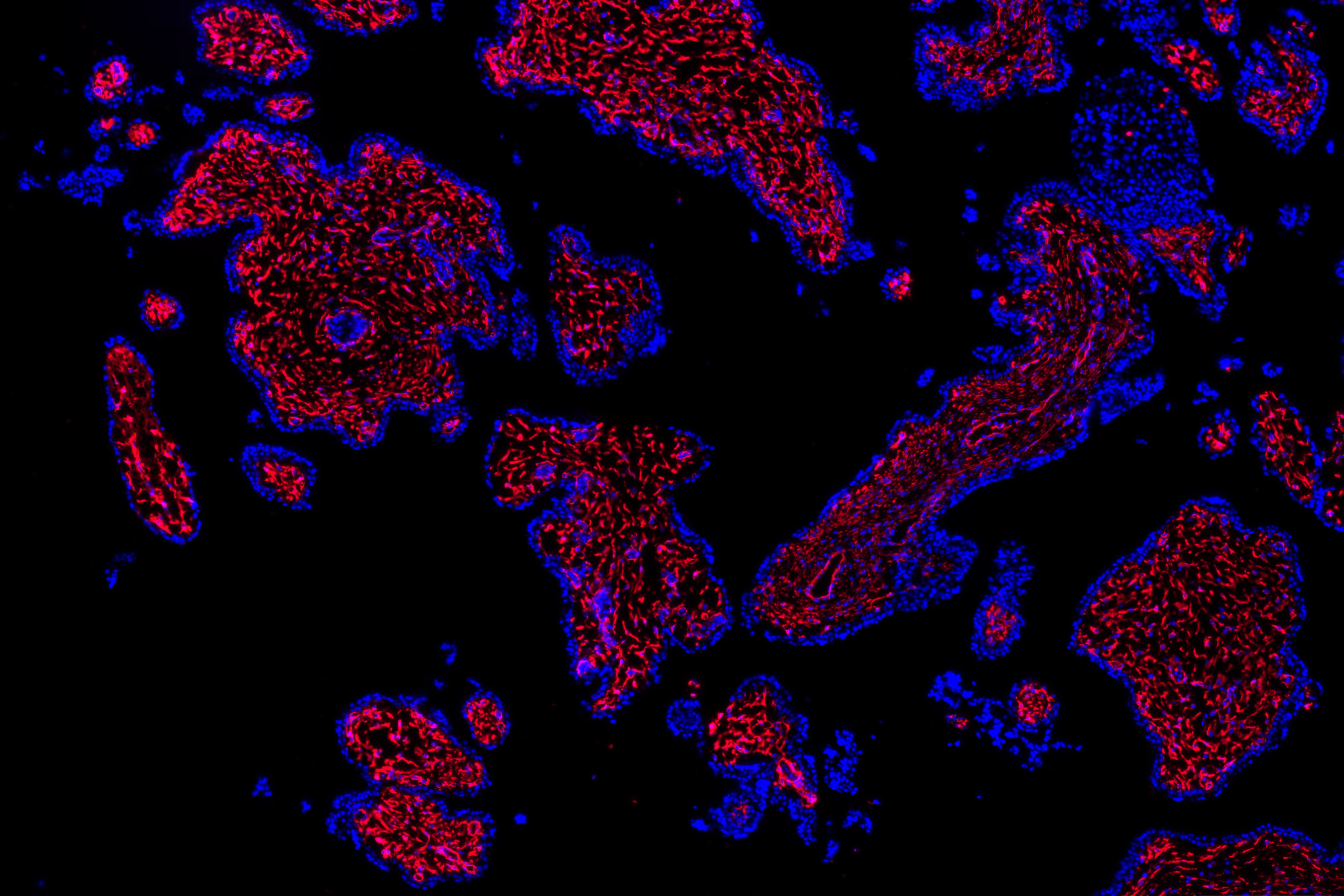 Researchers have mapped more than 20 different cell types present in the first-trimester human placenta, including stromal and endothelial cells (red).