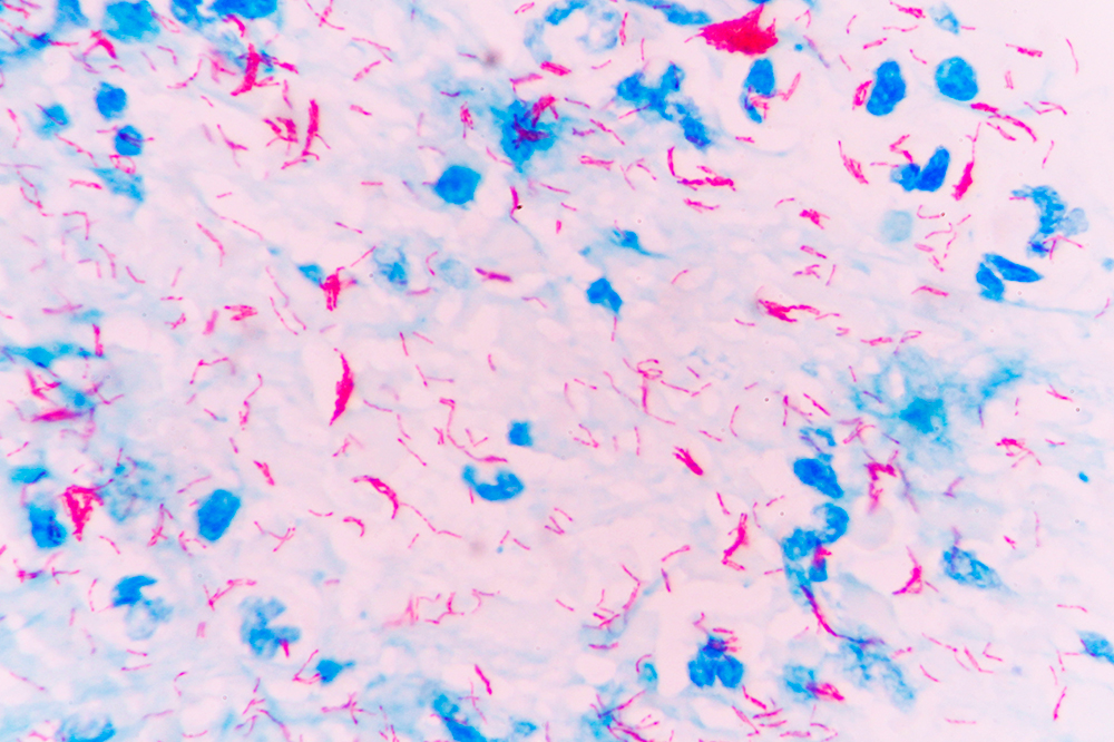 Mycobacterium tuberculosis 