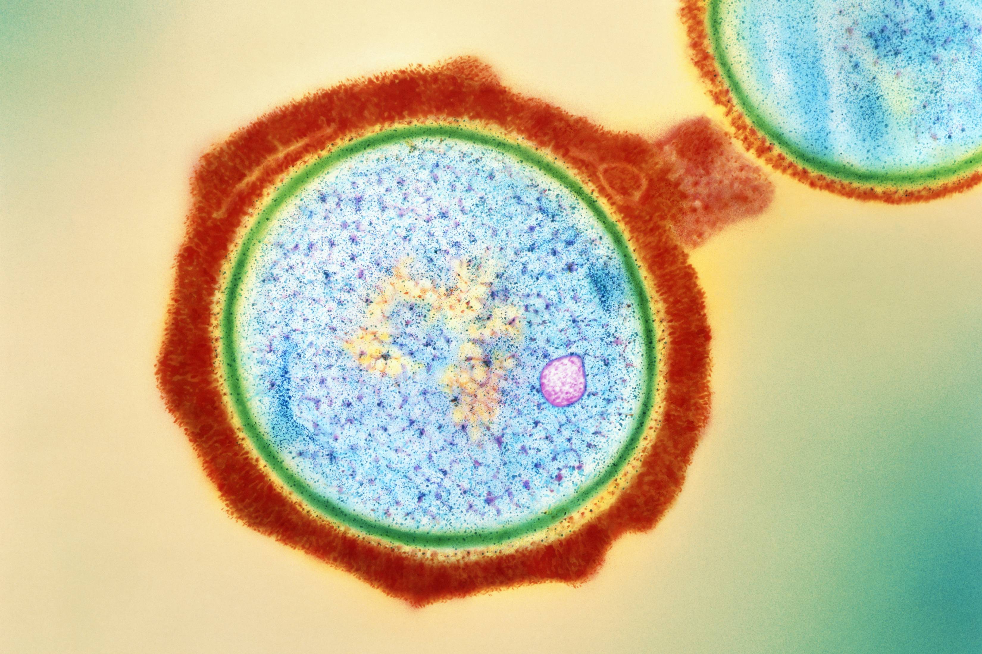 Infections caused by methicillin-resistant Staphylococcus aureus (pictured), can lead to serious health complications. Lysins help fight such infections by destroying the bacterium’s cell wall (green), thereby killing the microbe.