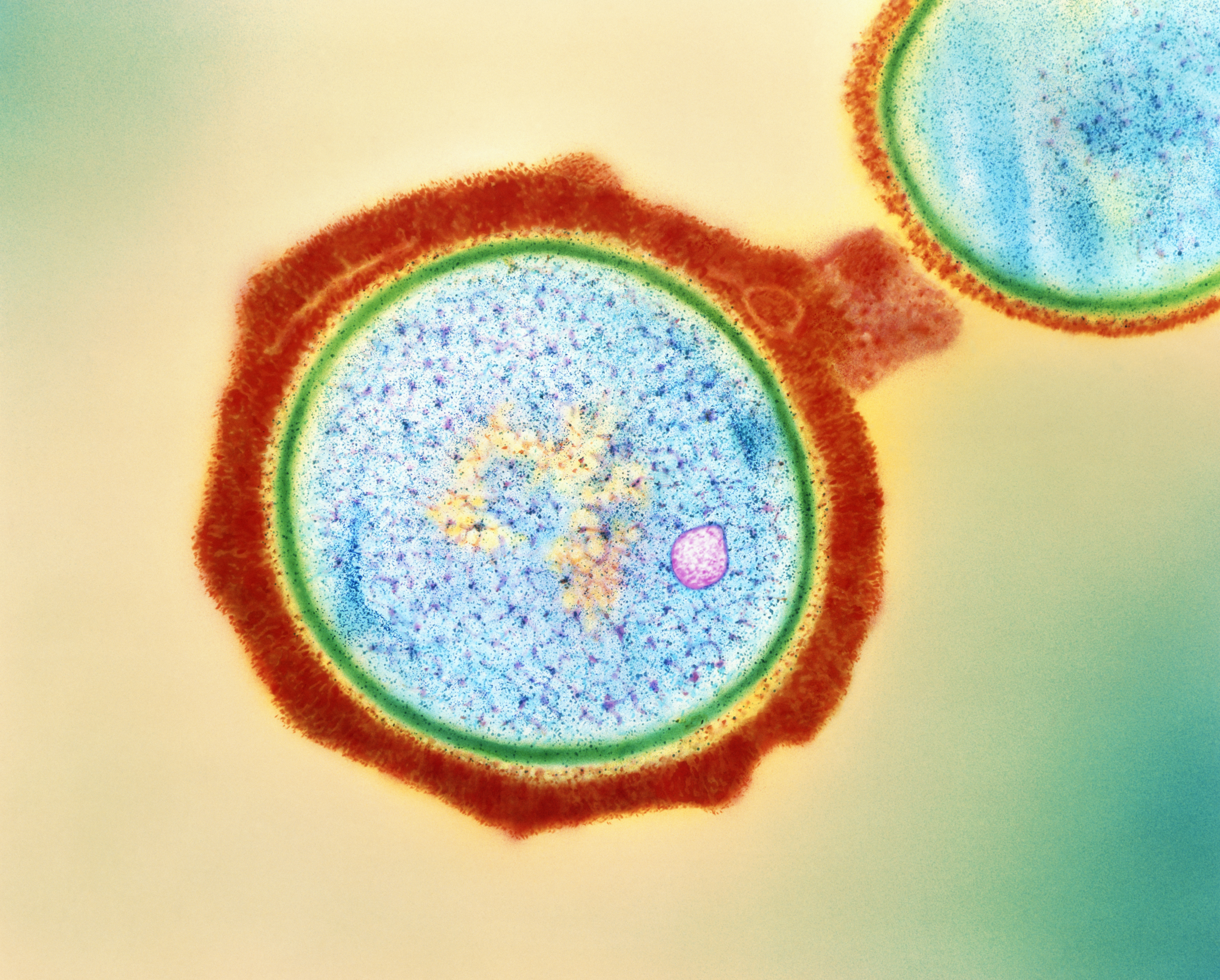 Infections caused by MRSA bacteria (pictured) can lead to serious health complications. Lysins kill the microbe by destroying the bacterium’s cell wall (green).