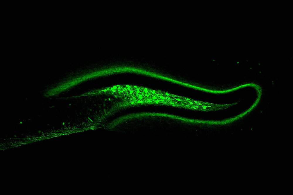 Activation of hD2R neurons