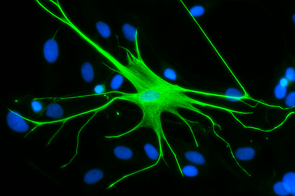 Human astrocytes