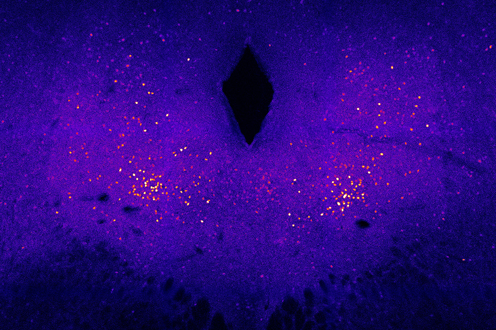 Brainstem neurons