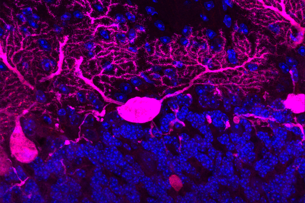 Nerve cells without PI31