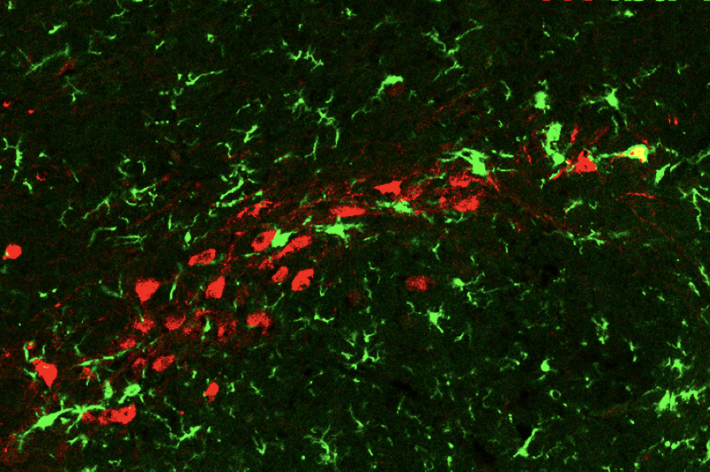 dopamine neurons