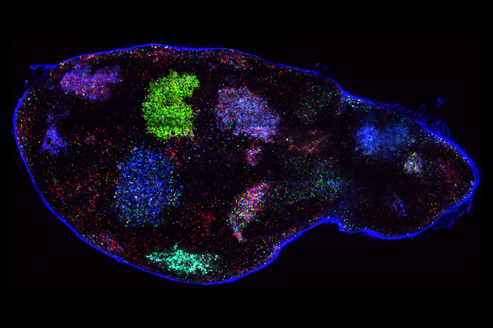 B cells in germinal centers