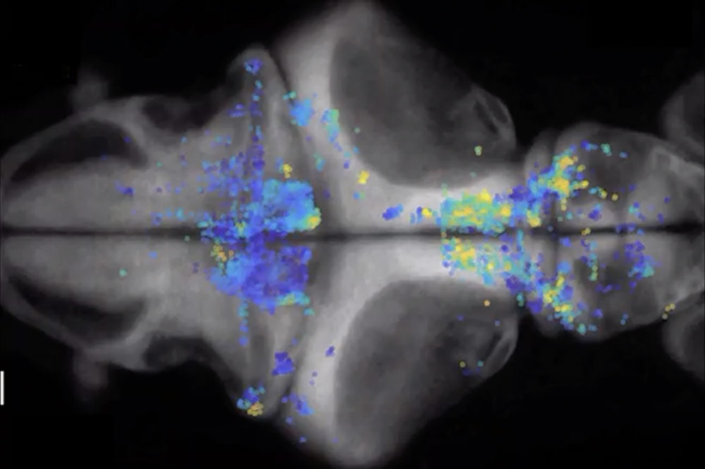 neuronal activity in a zebrafish brain