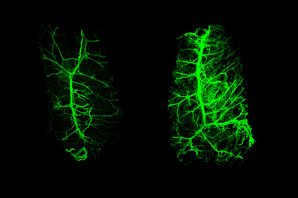 sympathetic innervation of adipose tissue