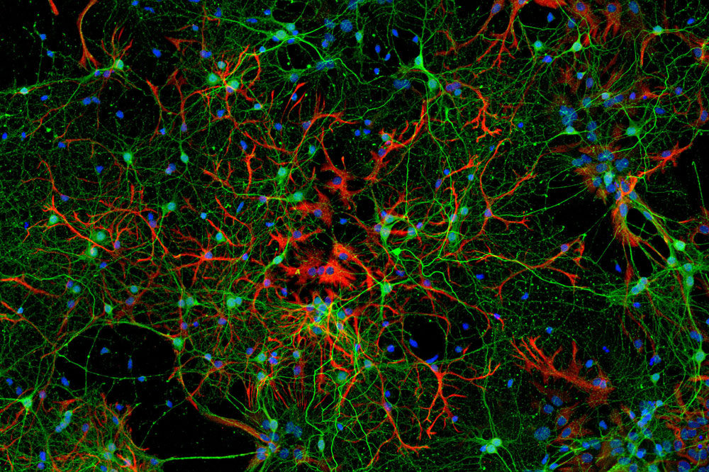 Mouse cortical neurons