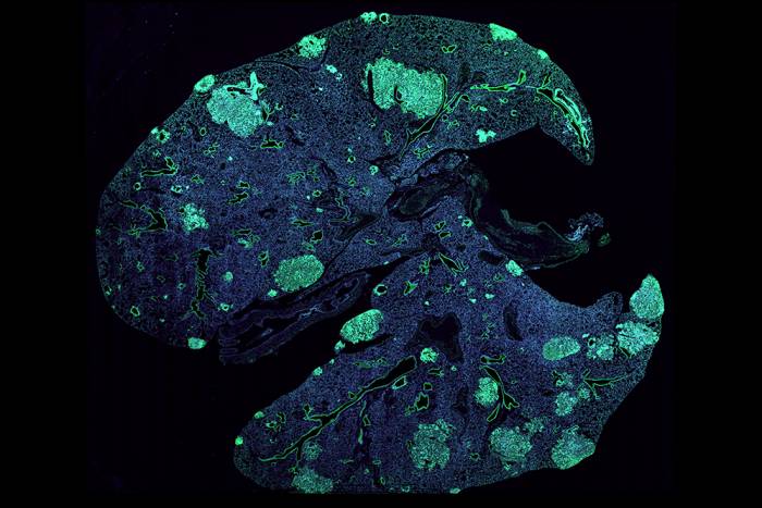 A mouse lung with metastases