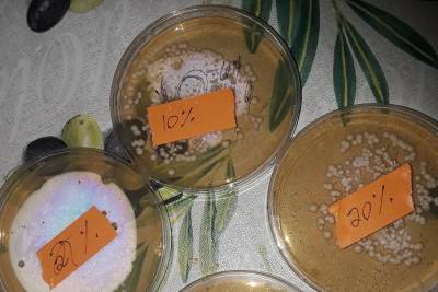 Plates of yeast by SSRP student