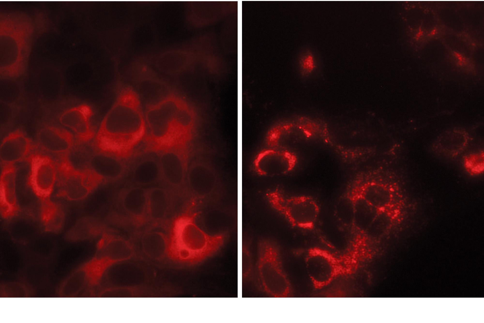 coronavirus tmem41b