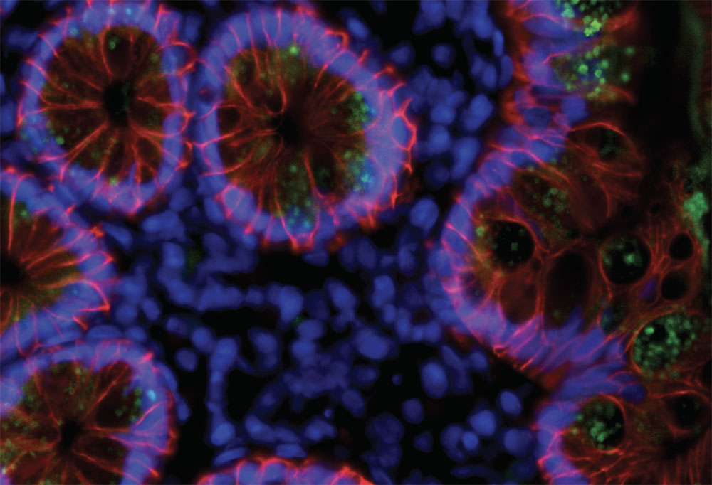 Coronavirus-intenstines-immunofluorescence