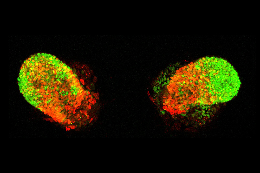 Synthetic lung buds