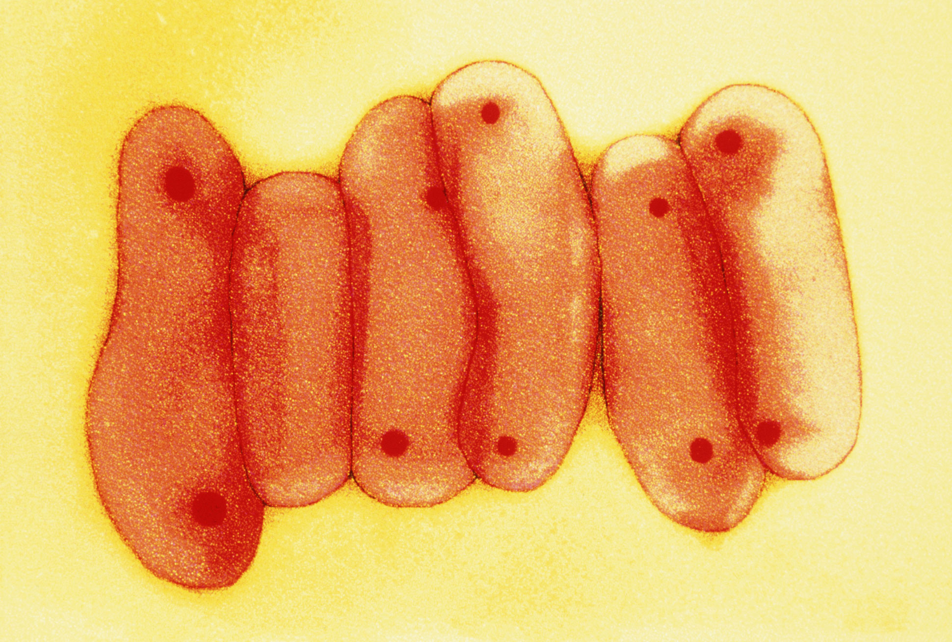 Mycobacterium tuberculosis bacteria