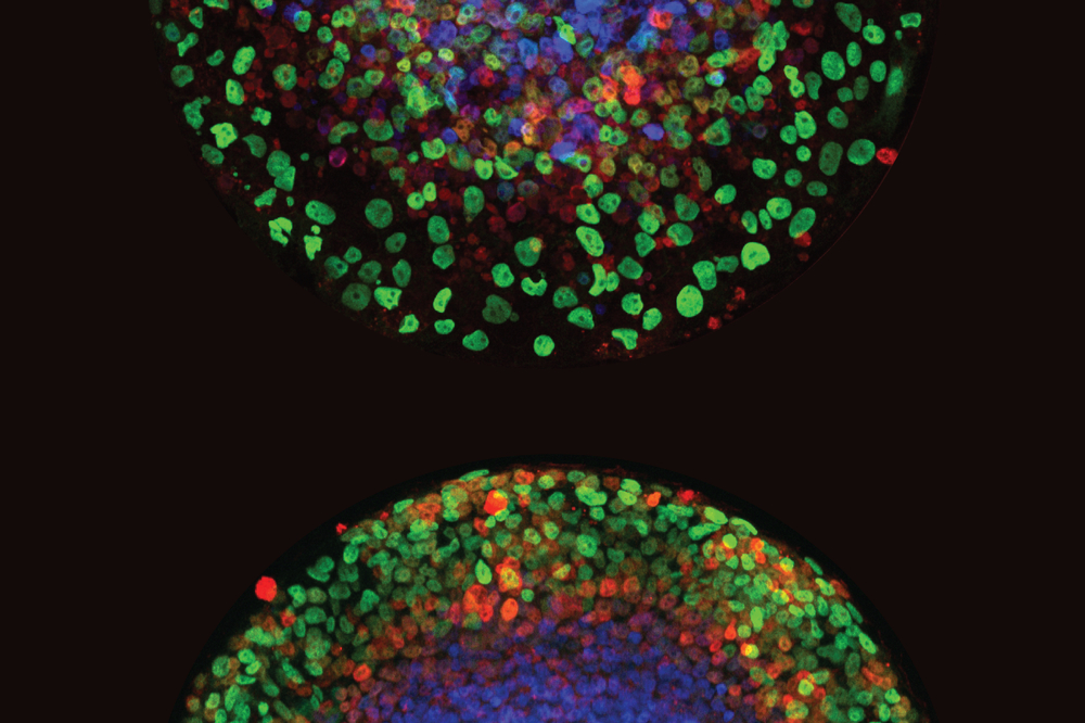 blastocysts