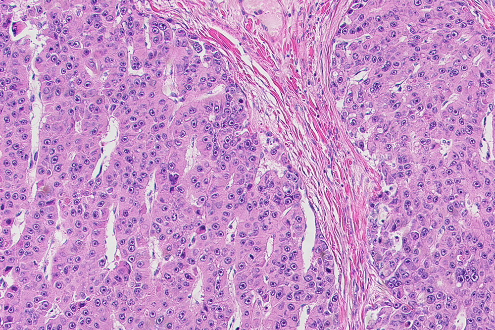 Fibrolamellar cells