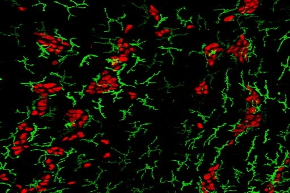 macrophages foodborne