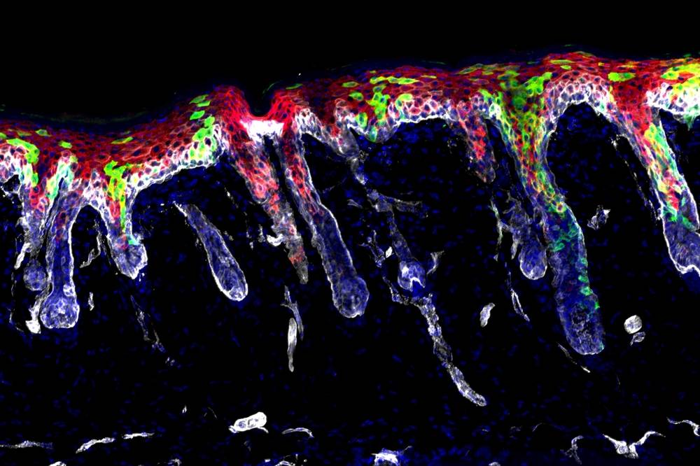 hair follicle stem cells