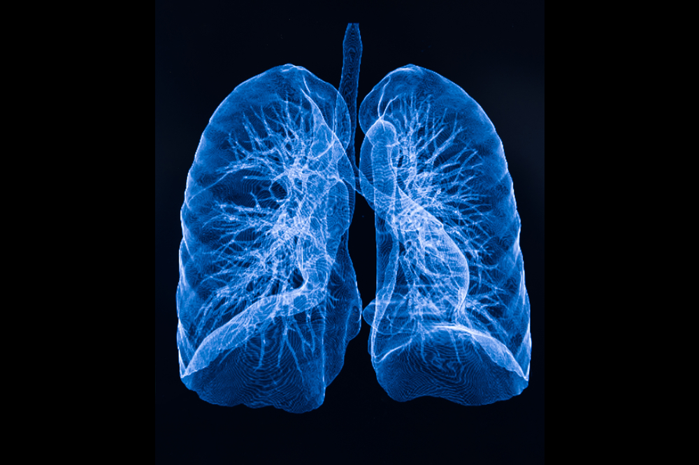 lung image