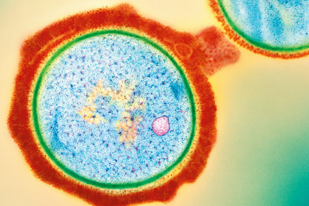 Staphylococcus aureus: A new mechanism involv