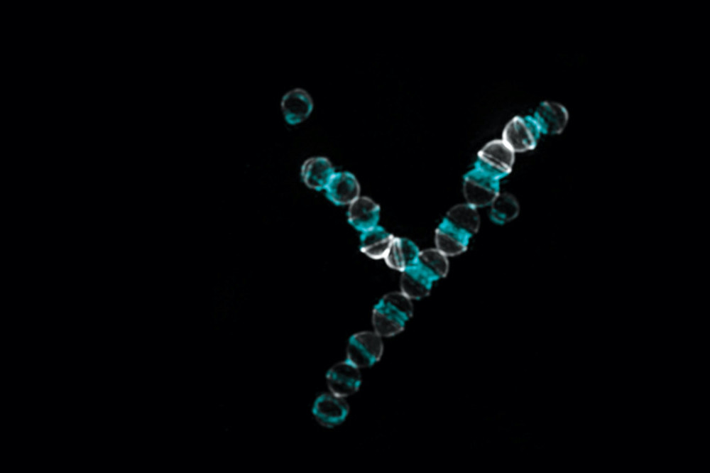 streptococcus pyrogens